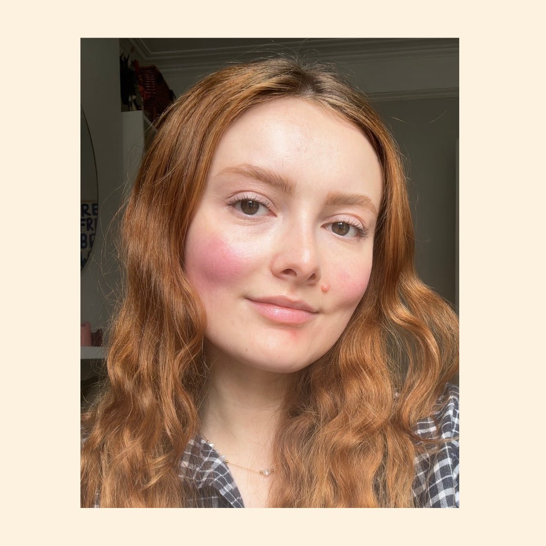 BBL laser rosacea results